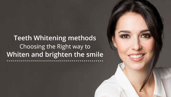 Blog TeethWhitening 3 HSG