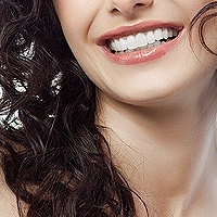 service smile makeover